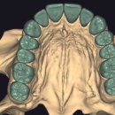 모델리스 치과기공소 이미지