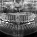 더바른윤치과의원 이미지