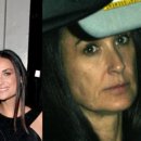 엔도테크놀러지 이미지