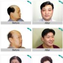 &lt;미래모 군산점&gt;군산남/여가발맞춤전문,환자용가발,M자탈모가발,에어컨가발,모발가발,앞머리가발등 군산...