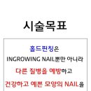 쵸코네일