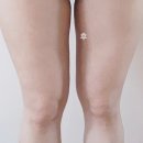 압구정피부과 여름휴가 얼마 안 남았는데 다이어트 관리 해야지, 뷰앤플의원에서