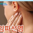 목 임파선염 증상 원인 치료 멍울 생기는 이유 이미지