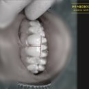 신원치과기공소 이미지