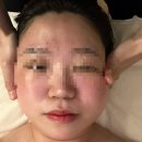 청주얼굴경락 끝판왕 복대동피부관리실 아름하다 재재재방문후기