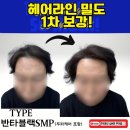 디블랙 | 창원 두피문신후기 좋은 곳![디블랙 창원점] 여성 헤어라인커버/정수리커버두피문신