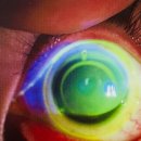 글라스닥터 렌즈아이 이미지