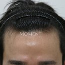 모먼트의원 이미지