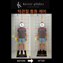 연승환치과의원 | 미사남자필라테스 턱관절통증 '이것'부터 체크해 보세요.