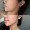 [강서구 피부관리] 뷔에고 에스테틱 윤곽관리 솔직후기