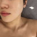 용인 피부관리 올가드림뷰티 삼가점 초음파 리프팅 후기