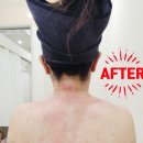 감일365약국 | 송파위례 피부관리 올가드림뷰티 하남감일점 목어깨관리 후기