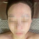이윤정 뷰티스킨 | [서울 은평구] 응암동마사지 샵 추천, 이윤정뷰티스킨 / 인생 첫 얼굴경락 후기