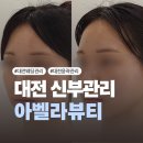 183-1-000009 | [대전] 대전 신부관리 찾다가 인생샵 발견💥 탄방동 아벨라뷰티 윤곽관리 찐후기