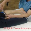 Soft Tissue Solution ( 한국형 그라스톤 ) 새제품입니다. 이미지