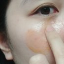 문제성피부엔 아가스 포유 강남앰플 락토실 필