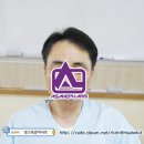원권 아이롱 시술 (남자 머리 2) 이미지