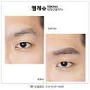 서면엘레슈의원 이미지