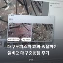 대구두피스파 받고 달라진 점, 셀비오 대구중동점 후기