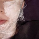 알파광주 | 광주피부과추천 고주파리프팅 덴서티 알파 600샷 후기