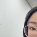 써클렌즈 20년 착용한 -6 고도근시의 스마일라식 후기 (수술중 눈을 깜빡여버린 멍청이가 나예요)