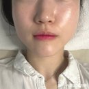아크로타워(아)경로당 | 평촌피부관리 디또뷰티 안양범계점, 여름철 속건조 압출까지 제대로 받고 온 후기