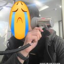 청담이비인후과의원 | 이개혈종(aka. 만두귀) 초기 증상과 절개 배액 치료 후기