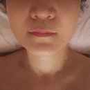 더포레스트스킨 이미지