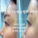 더빛나는피부클리닉 | 하단 속눈썹펌 잘하는곳 하단 빛나는속눈썹왁싱피부, 짧은 속눈썹도 살아난 블랙틴팅 후기