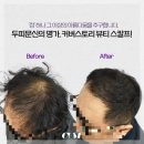 목포SMP두피문신 전문 샵, 커버스토리! 고객 후기에서 증명된 믿음직한 선택입니다.
