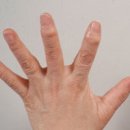 손가락 마디 통증 이유가 뭘까? 손가락 관절염 과 염증 . 이미지