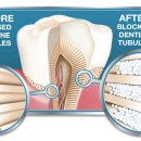 상아치과재료 이미지