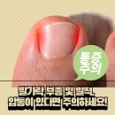 성모류마내과의원 | 내과유무통풍 궁금할 때 대사질환인 통풍의 내과적 관리법 확인