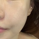 베테랑테라피 | 평촌피부관리 받고 달걀형 라인 완성! 평촌 윤곽관리 이경연뷰터테라피 후기