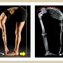 Trunk Forward Flexion Dysfunction 케이스 이미지