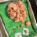 연세모아요양병원 | [연세사랑모아여성병원] 자궁근종 로봇수술 후기