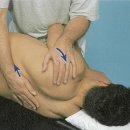 (치료)Sidelying unilateral transverse FM(Extension증가목적) 이미지