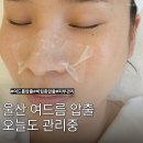울산 여드름 오늘도 관리중 여드름압출 피부관리 비립종 물방울재생