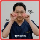 청맥 | 정계정맥류 수술 후기, 비아그라 없이 해결된 남성 건강 고민