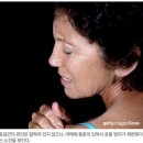 유착성 관절낭염 이미지