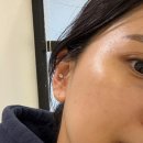 방죽안오거리2 | 천안 신부동피부관리 샵토탈뷰티살롱 수분관리 후기