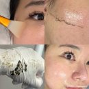 성북 피부관리 잘하는곳 도도미 왁싱 에스테틱 월곡본점 세라링 후기