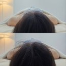 초록마을 경산중산점 | 물오른피부 경산 | 예민한 피부에 유산균을 가득💭 프리즘관리, 교정데콜테관리 후기