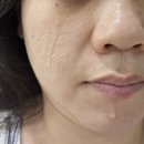 리베스킨 광필 에크덤 4종 홈케어 세트로 울긋불긋한 피부 즉각적인 진정케어