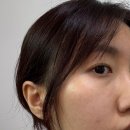 로로스킨케어 이미지