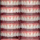 거성치과기공소 이미지