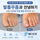 부천역곡건강생활 | 부천 발관리 페디프로 역곡점｜남편의 문제성 무좀 발톱 케어 솔직후기🦶🏻💡