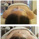 청주피부관리 마인에스테틱에서 &#39;RSPT 라운드숄더&#39; 교정 받고 온 후기