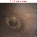 스위스안경보청기by안경매니져 | 노원역 보청기, 구매 당일 바로 착용 가능한 보청기 저렴하게 구매한 후기!