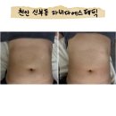 천안 신부동 복부관리 추천 라비다에스테틱 후기